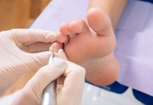 Understanding Inflammation Patterns With a Plantar Fasciitis Doctor plantar fasciitis doctor