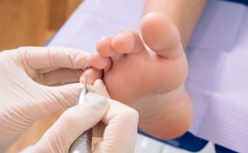 Understanding Inflammation Patterns With a Plantar Fasciitis Doctor plantar fasciitis doctor